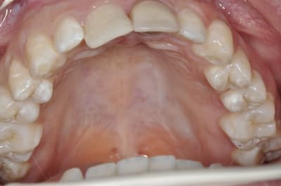 Dsc 0417 ixowhv - Eugenol