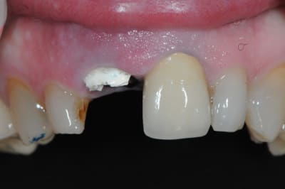 Dsc 0461 gqlfu8 - Eugenol