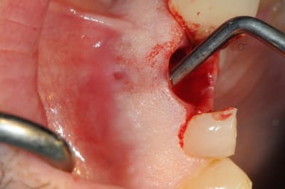 Dsc 0487 nmrazq - Eugenol