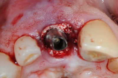 Dsc 0493 ejl3rx - Eugenol