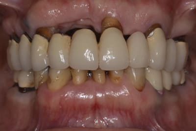 Dsc 0498 sakx49 - Eugenol