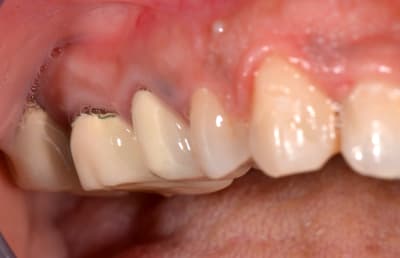 Dsc 0511 scecsv - Eugenol