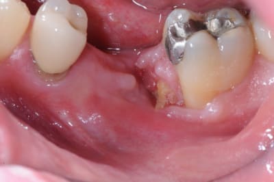 Dsc 0602 g3ilw2 - Eugenol