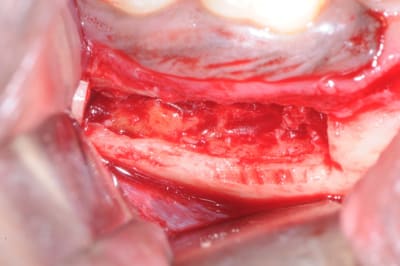 Dsc 0611 xxkkl8 - Eugenol