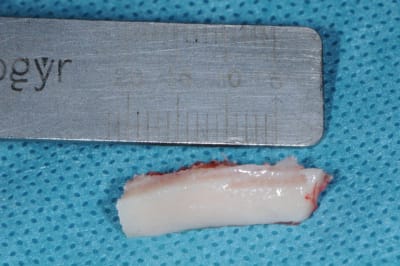 Dsc 0615 ulkt0q - Eugenol