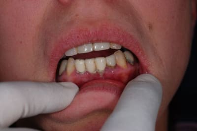 Dsc 0735  800x600  sgv9at - Eugenol