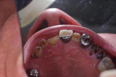 Dsc 1196 ytyabk - Eugenol