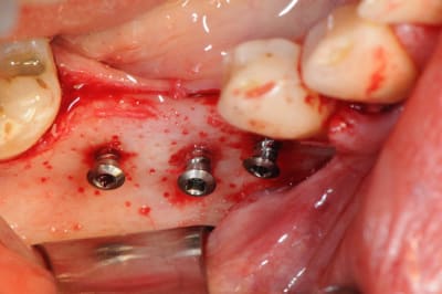 Dsc 1407 jl9x73 - Eugenol