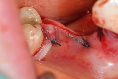 Dsc 1416 ezuxt1 - Eugenol