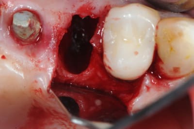 Dsc 1550 hd0vvg - Eugenol