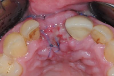 Dsc 1550 tfiv7y - Eugenol