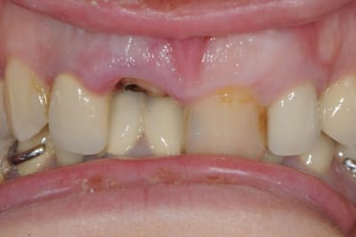 Dsc 1581 rycx1w - Eugenol