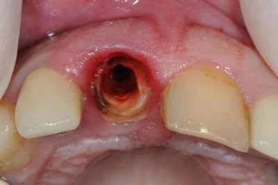 Dsc 1583 nbxq6q - Eugenol
