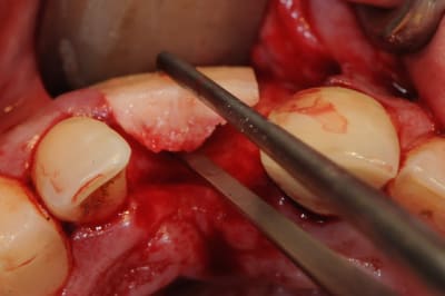 Dsc 1611 agzzlo - Eugenol