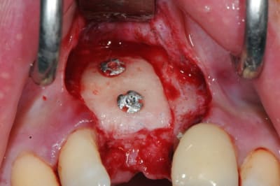 Dsc 1649 ernzfw - Eugenol