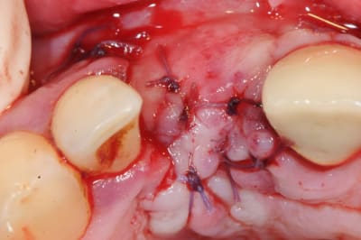 Dsc 1676 wzsqrx - Eugenol