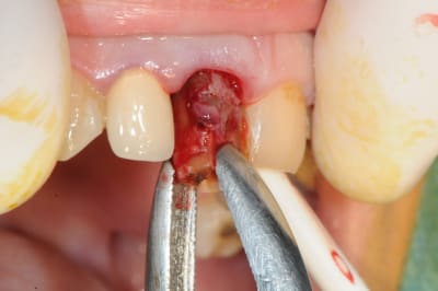 Dsc 1688 haqkya - Eugenol