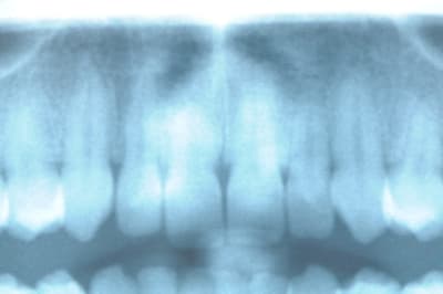 Dsc 1698 emn5bo - Eugenol