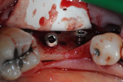 Dsc 1701 ktygdv - Eugenol