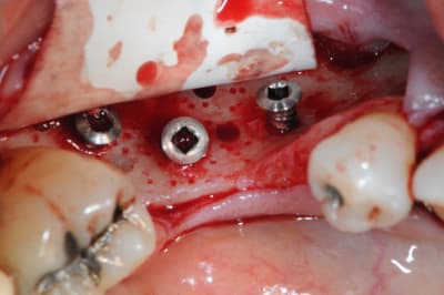 Dsc 1703 pr57u5 - Eugenol