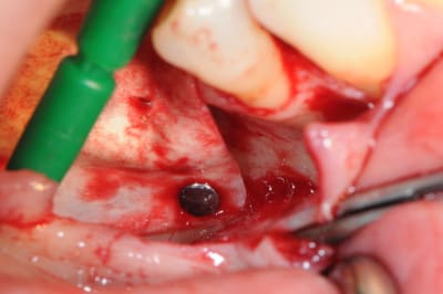 Dsc 1705 vmuloc - Eugenol