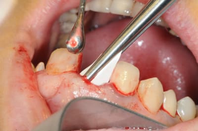 Dsc 1708 wju3qi - Eugenol