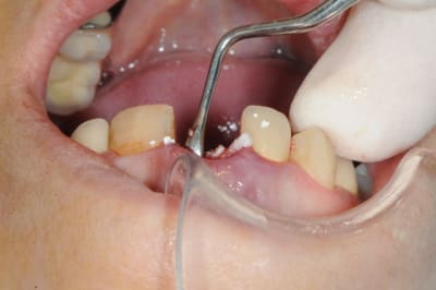 Dsc 1766 fqy9bv - Eugenol