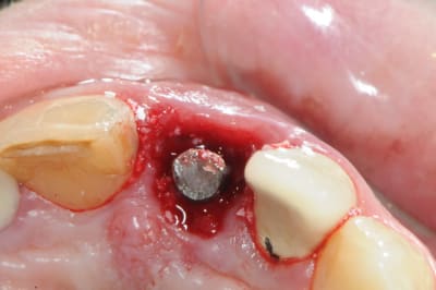 Dsc 1768 yx8gus - Eugenol