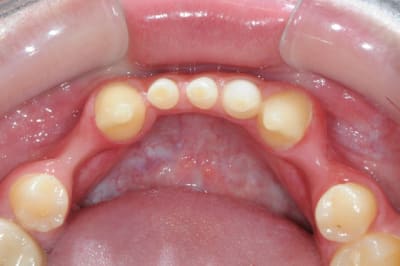 Dsc 2183 itgvvk - Eugenol