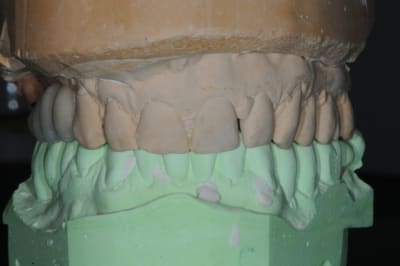 Dsc 2337 icbf3a - Eugenol