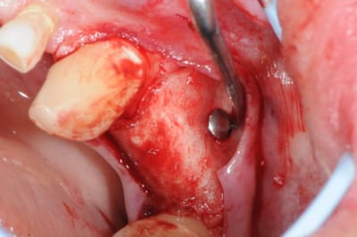 Dsc 2492 lephkm - Eugenol