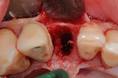 Dsc 2523 pmzwsa - Eugenol