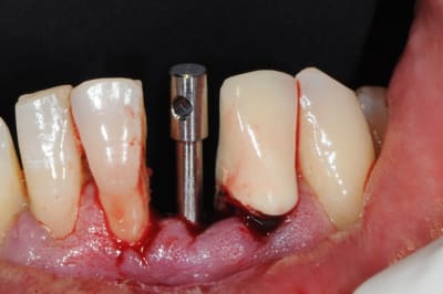 Dsc 2532 ntx3vd - Eugenol