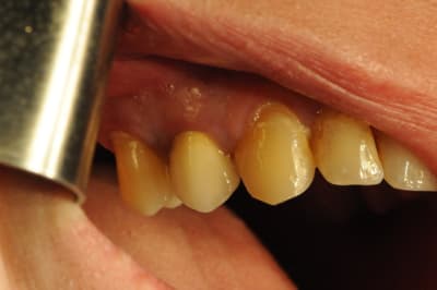 Dsc 2550 umgf0s - Eugenol