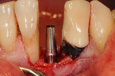 Dsc 2555 d3ucyh - Eugenol