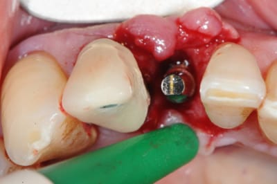 Dsc 2559 wqbeos - Eugenol