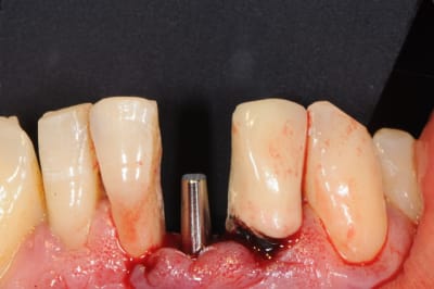 Dsc 2563 qnsyx3 - Eugenol