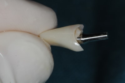 Dsc 2574 v0bzyn - Eugenol