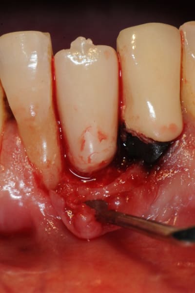 Dsc 2589 zj0z4t - Eugenol