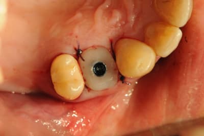 Dsc 2596 b8wrp8 - Eugenol