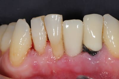 Dsc 2676 shcxty - Eugenol