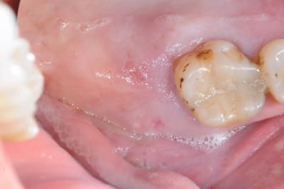 Dsc 2854 lr6t22 - Eugenol