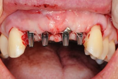 Dsc 3013 wayqmk - Eugenol