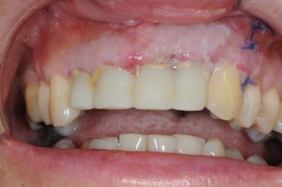 Dsc 3064 scgd1w - Eugenol