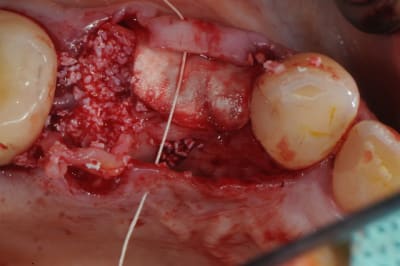 Dsc 3137 qtjbj6 - Eugenol