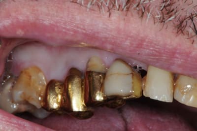 Dsc 3234 tj2yhp - Eugenol