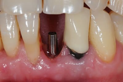 Dsc 3333 oo5v6n - Eugenol