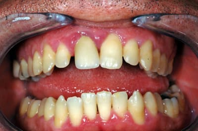 Dsc 3487 cecz0v - Eugenol