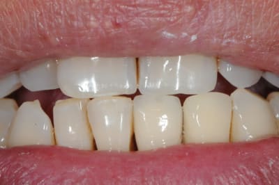 Dsc 3540 tafqf6 - Eugenol