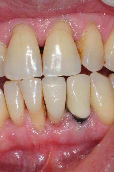 Dsc 3542 tr6taz - Eugenol